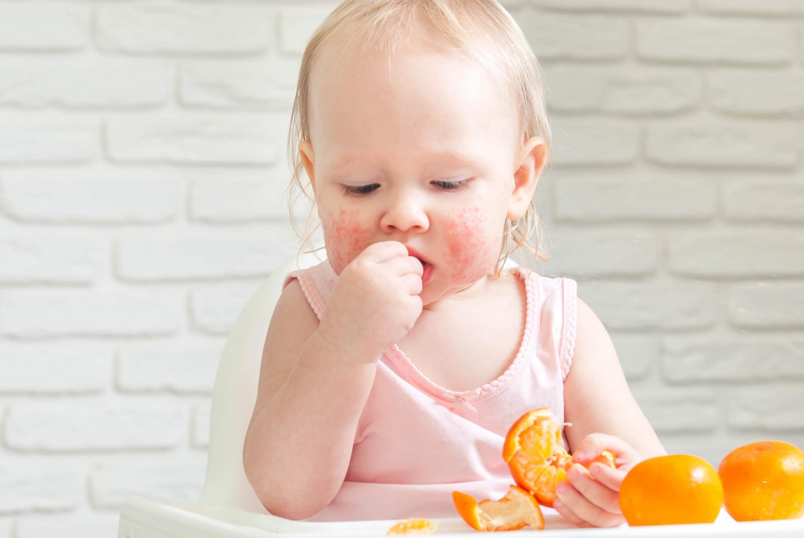 Διατροφή και τροφικές αλλεργίες στα μωρά 