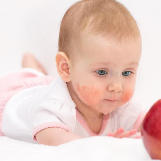 Διατροφή και τροφικές αλλεργίες στα μωρά 