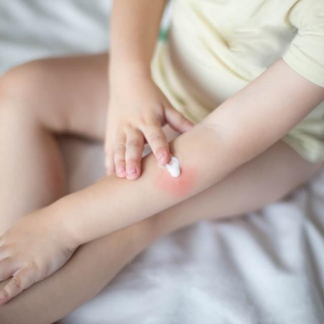 Τι σημαίνουν τα δερματικά εξανθήματα στο σώμα του παιδιού